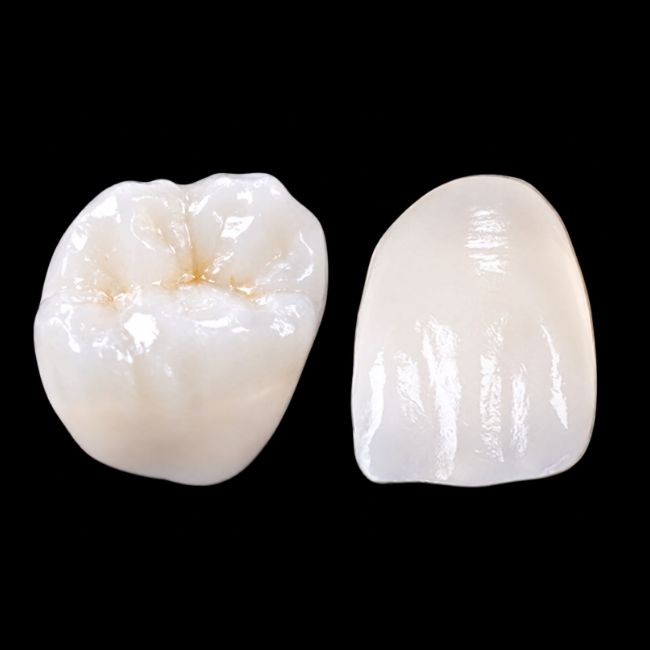 Crowns & Bridge Section - TDK Dental Lab